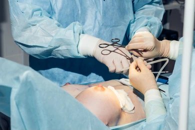 Nipple Surgery