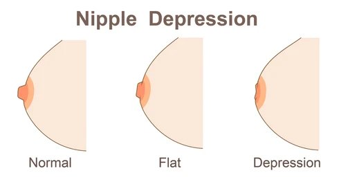 Nipple Surgery