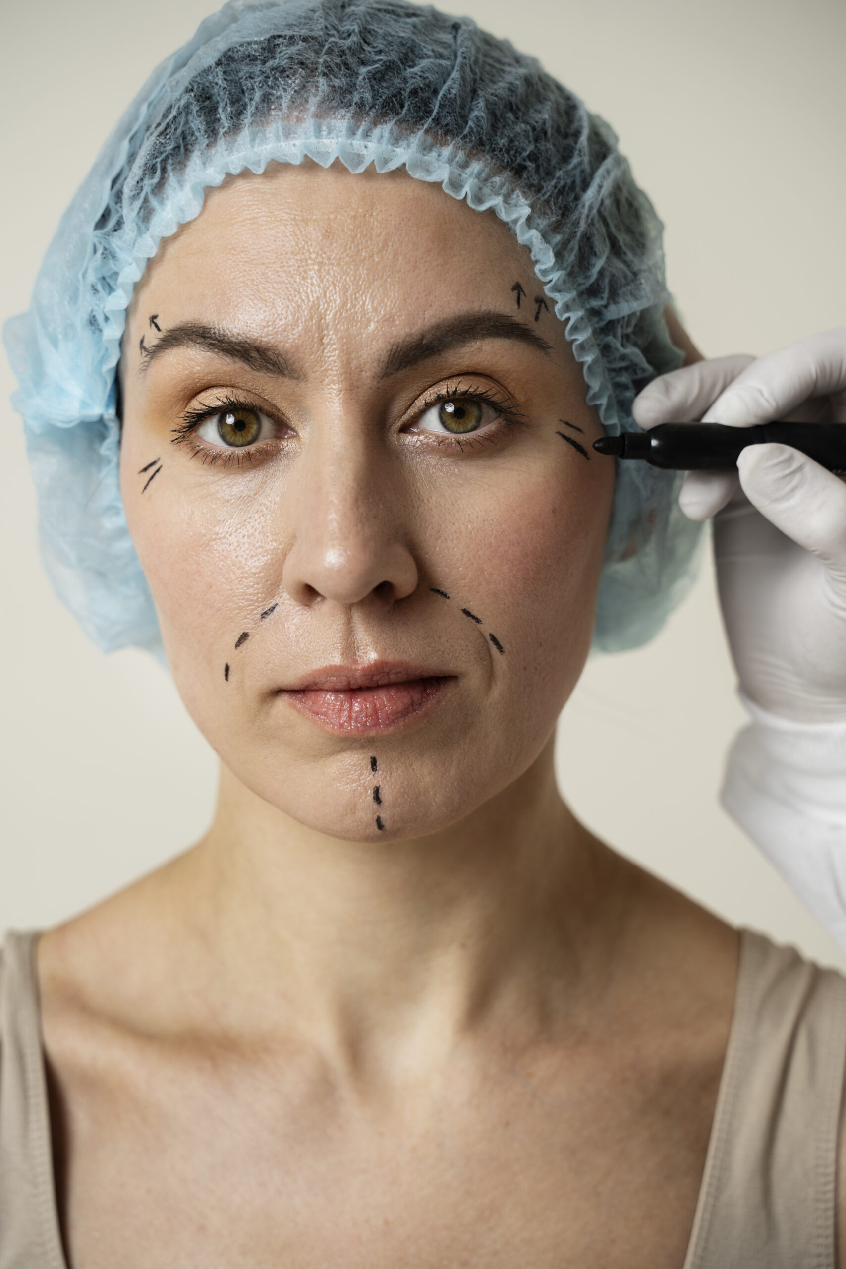 Chin and Neck Liposuction Scars
