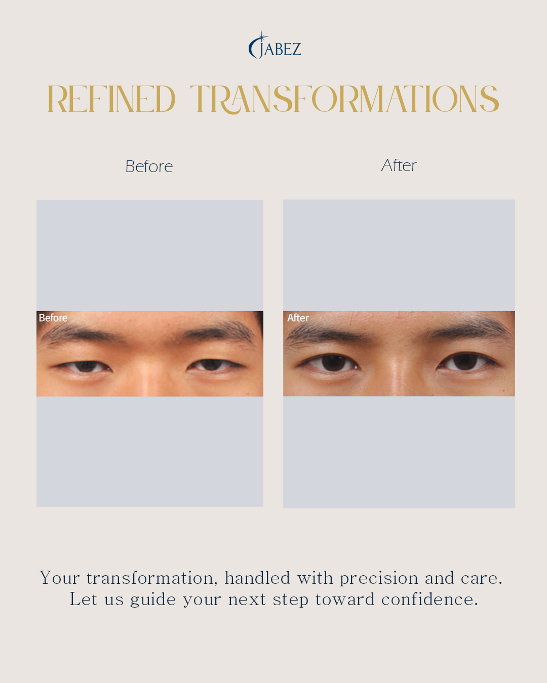 Meet Our Patients 31 eye treatment korea