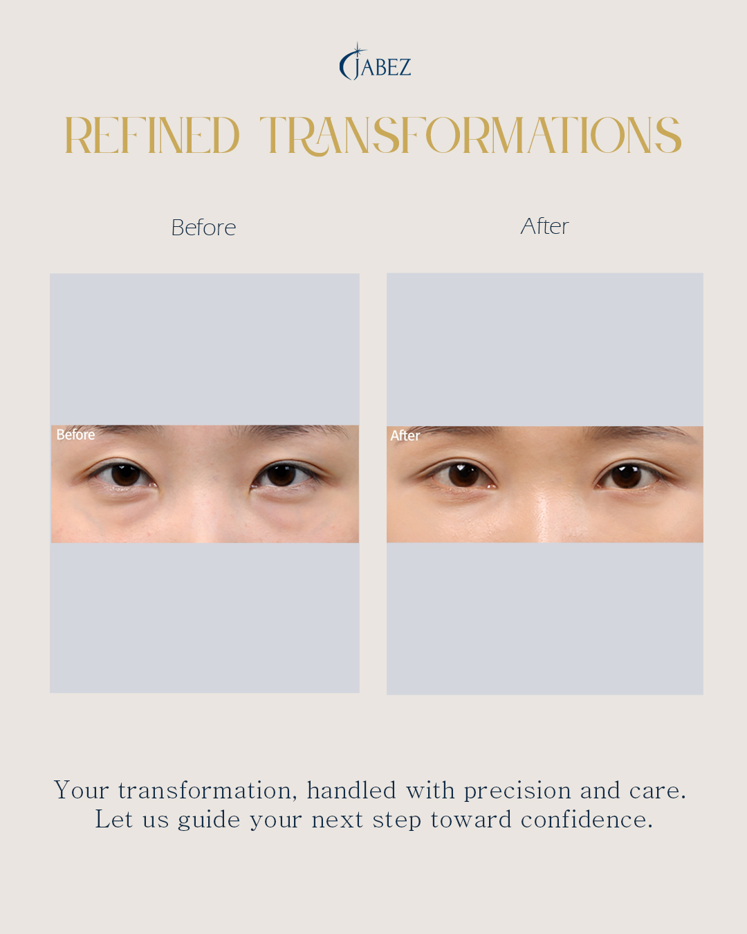 Meet Our Patients 85 eye treatment korea