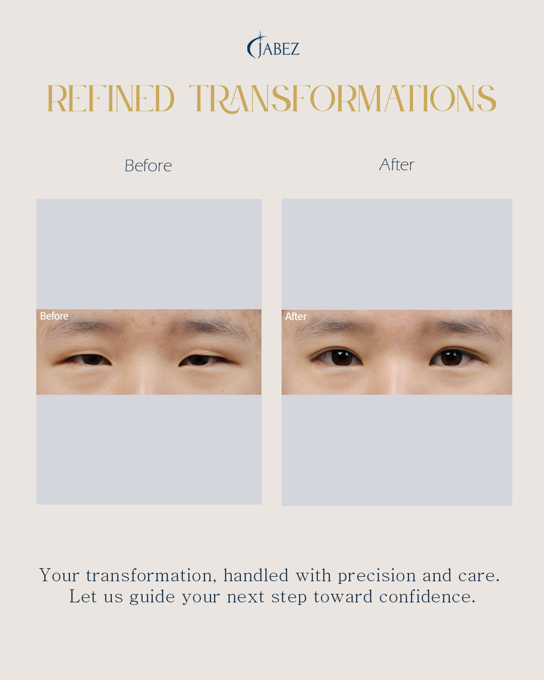 Meet Our Patients 1 eye treatment korea
