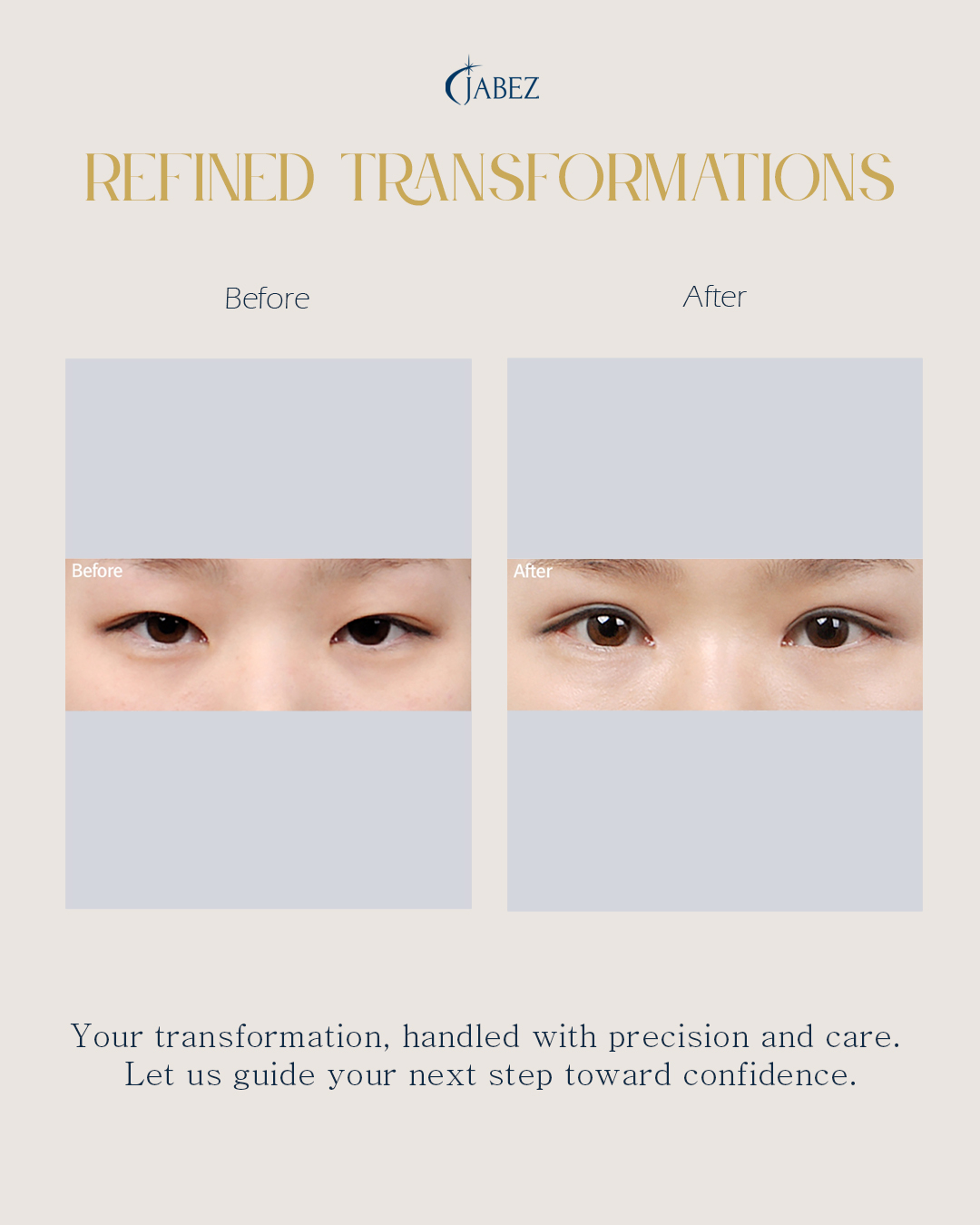 Meet Our Patients 10 eye treatment korea