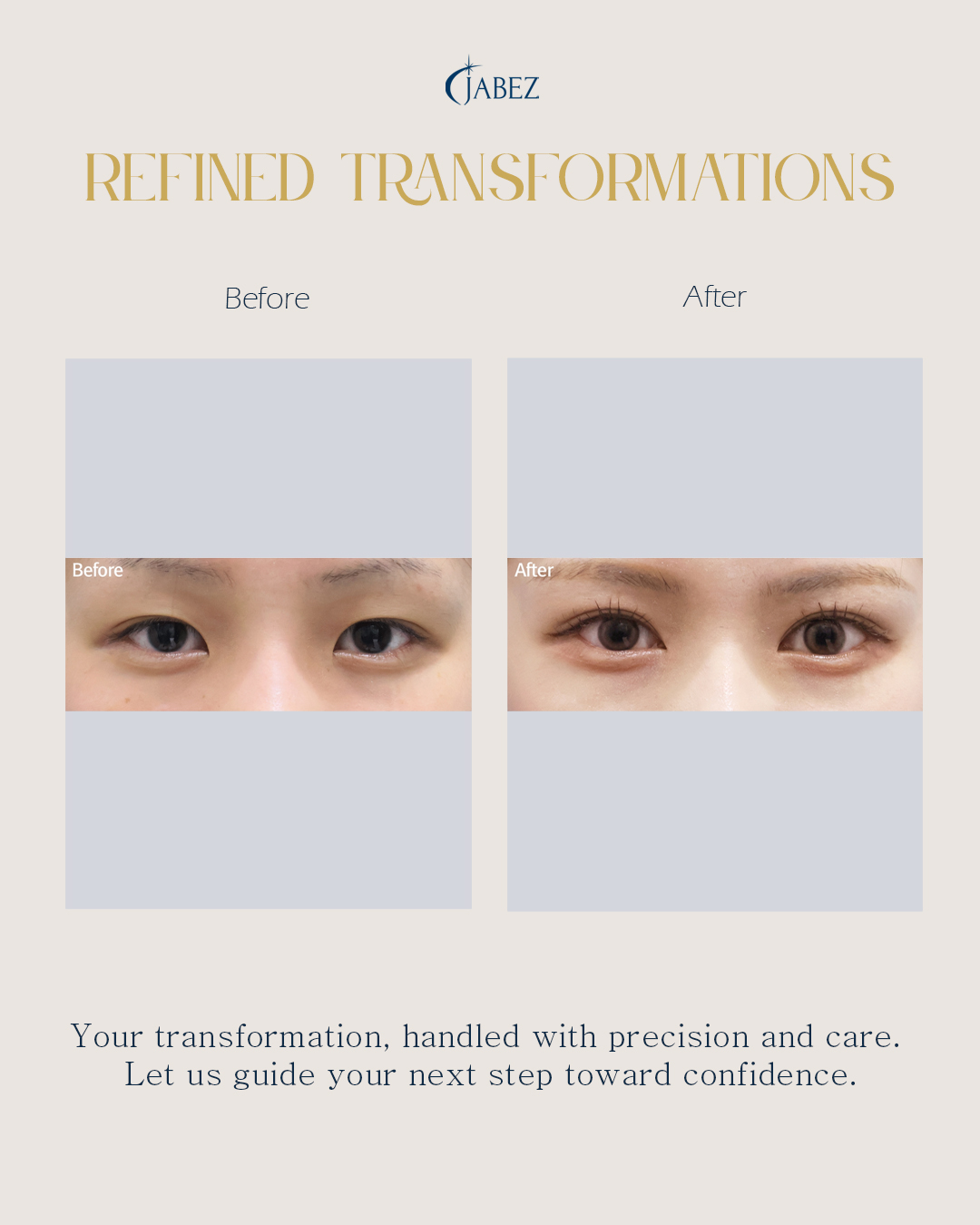 Meet Our Patients 11 eye treatment korea