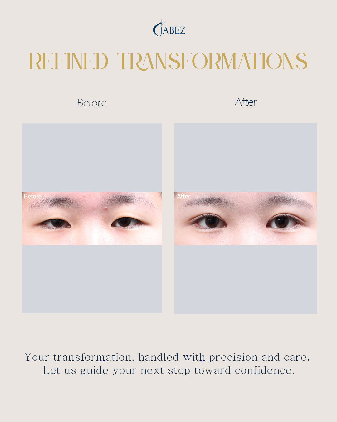 Meet Our Patients 12 eye treatment korea
