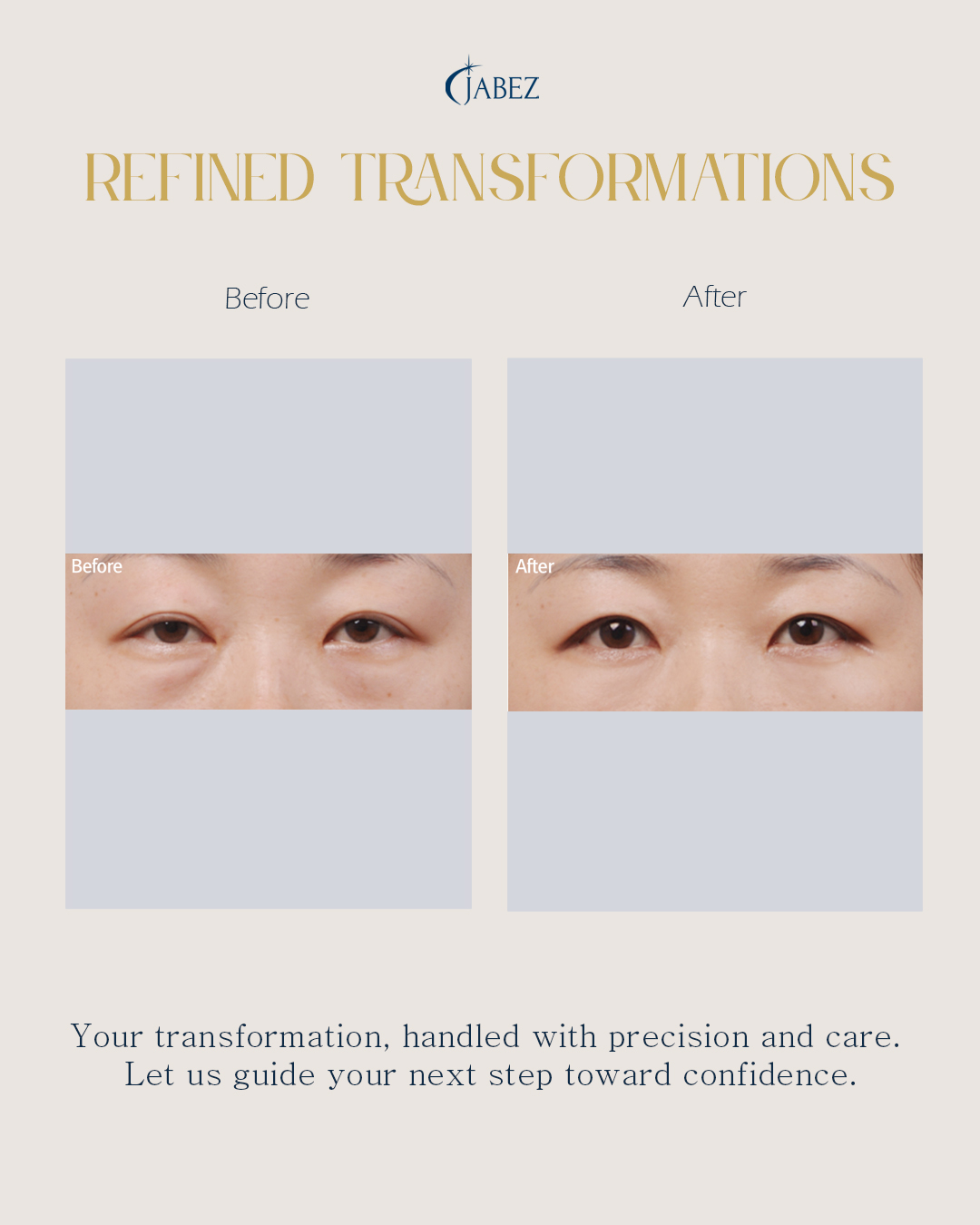 Meet Our Patients 13 eye treatment korea