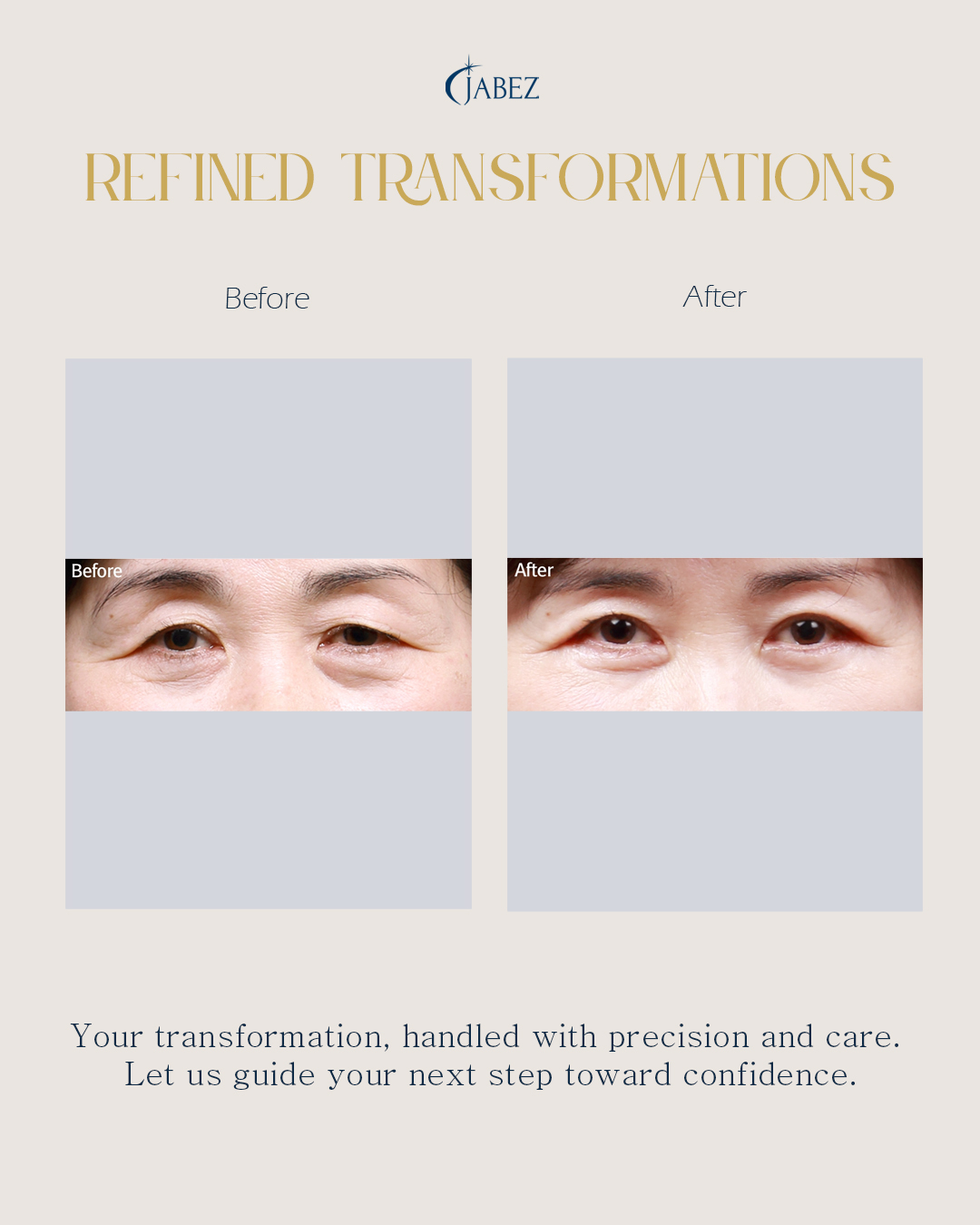 Meet Our Patients 14 eye treatment korea