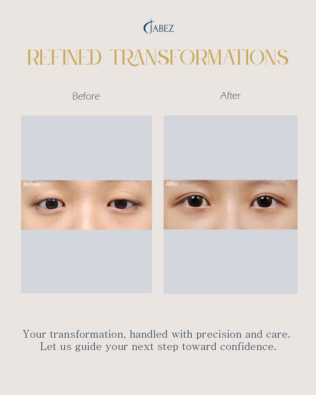 Meet Our Patients 15 eye treatment korea