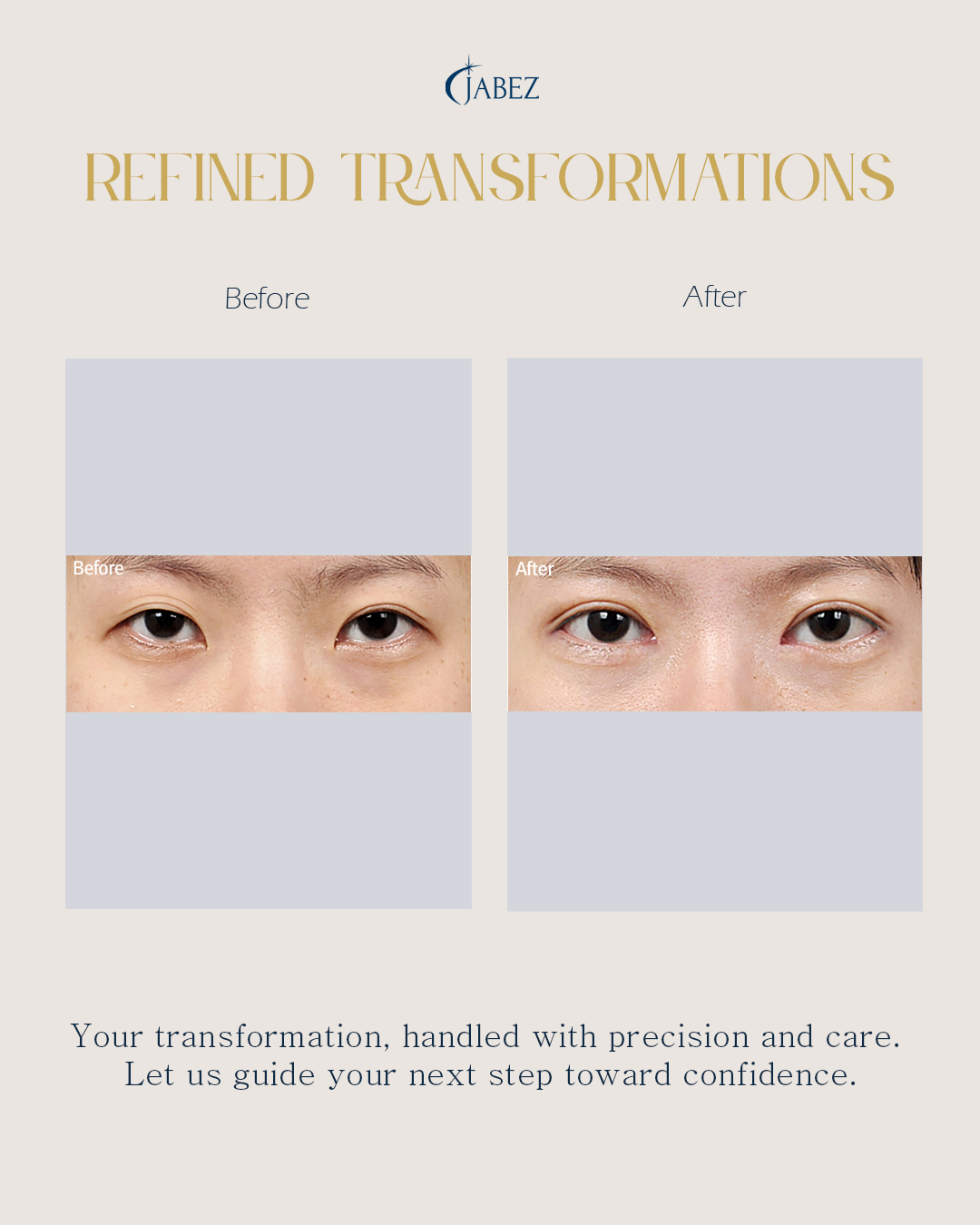 Meet Our Patients 16 eye treatment korea