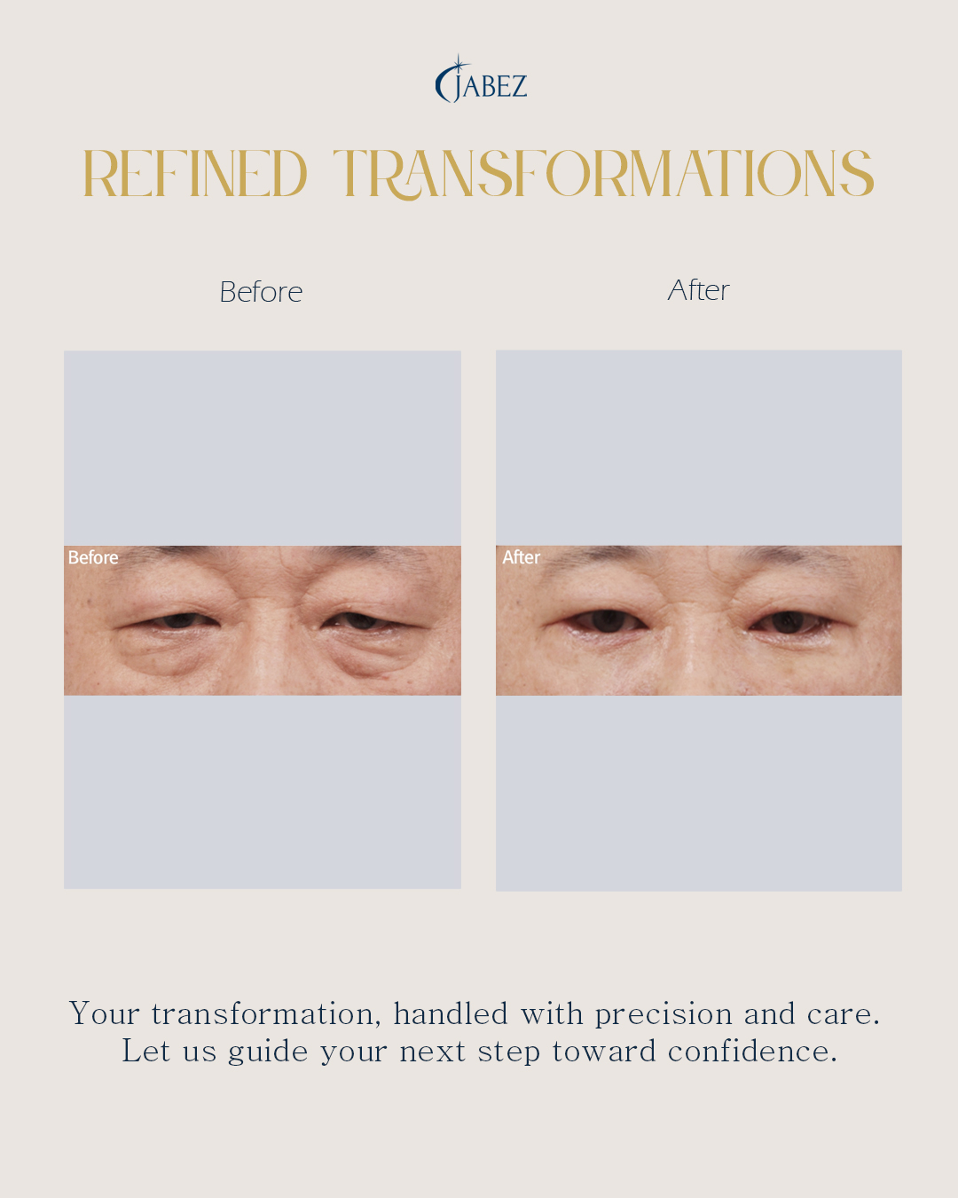 Meet Our Patients 17 eye treatment korea