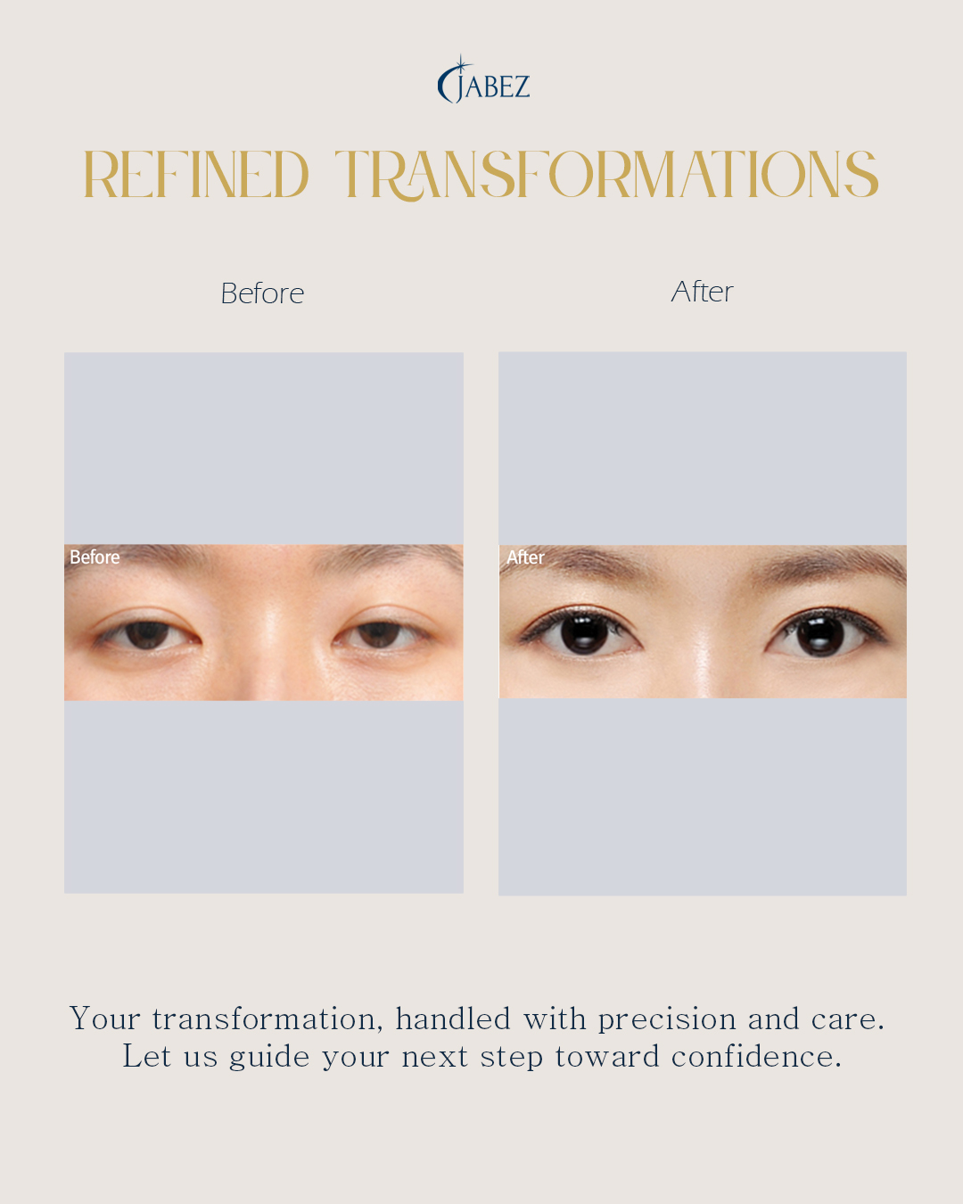 Meet Our Patients 18 eye treatment korea