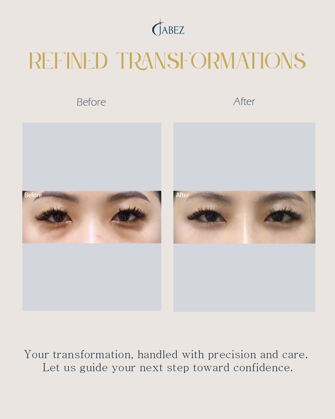 Meet Our Patients 19 eye treatment korea
