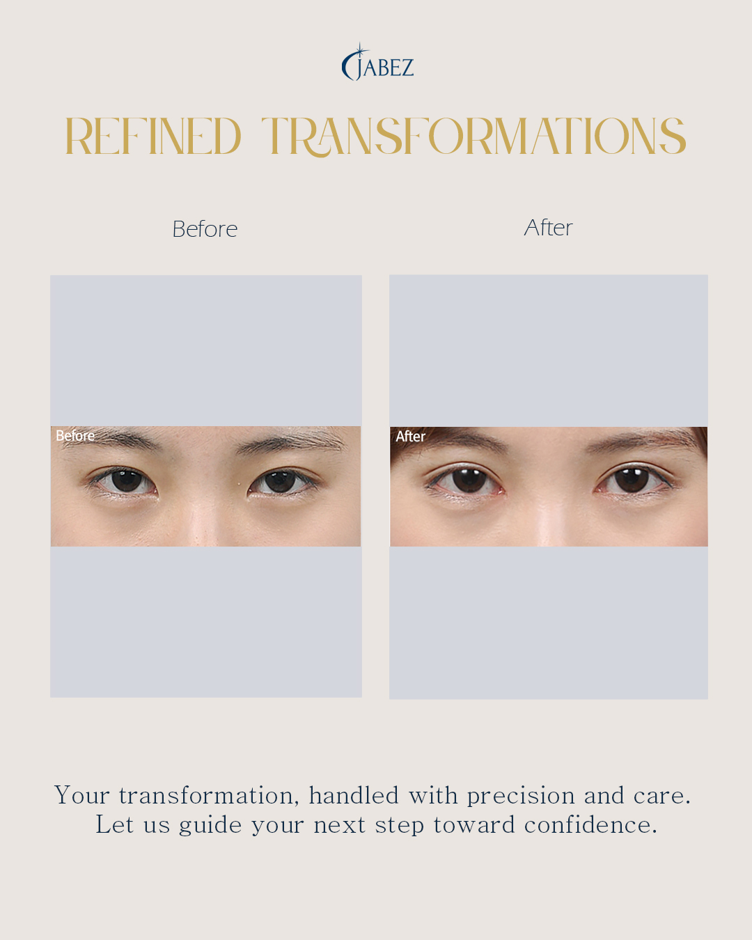 Meet Our Patients 2 eye treatment korea