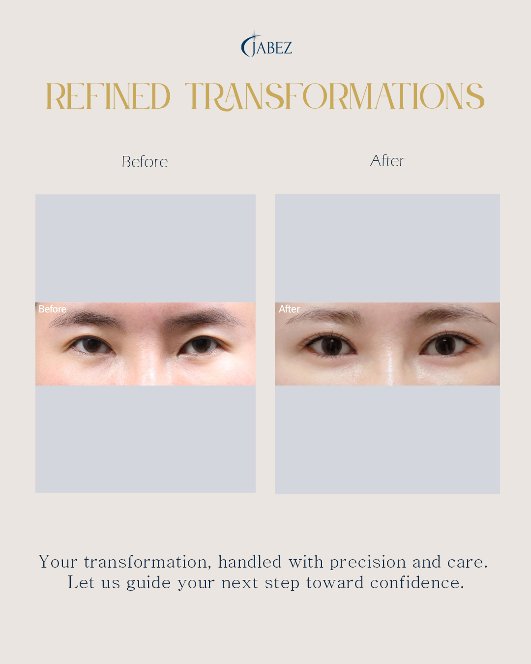 Meet Our Patients 20 eye treatment korea