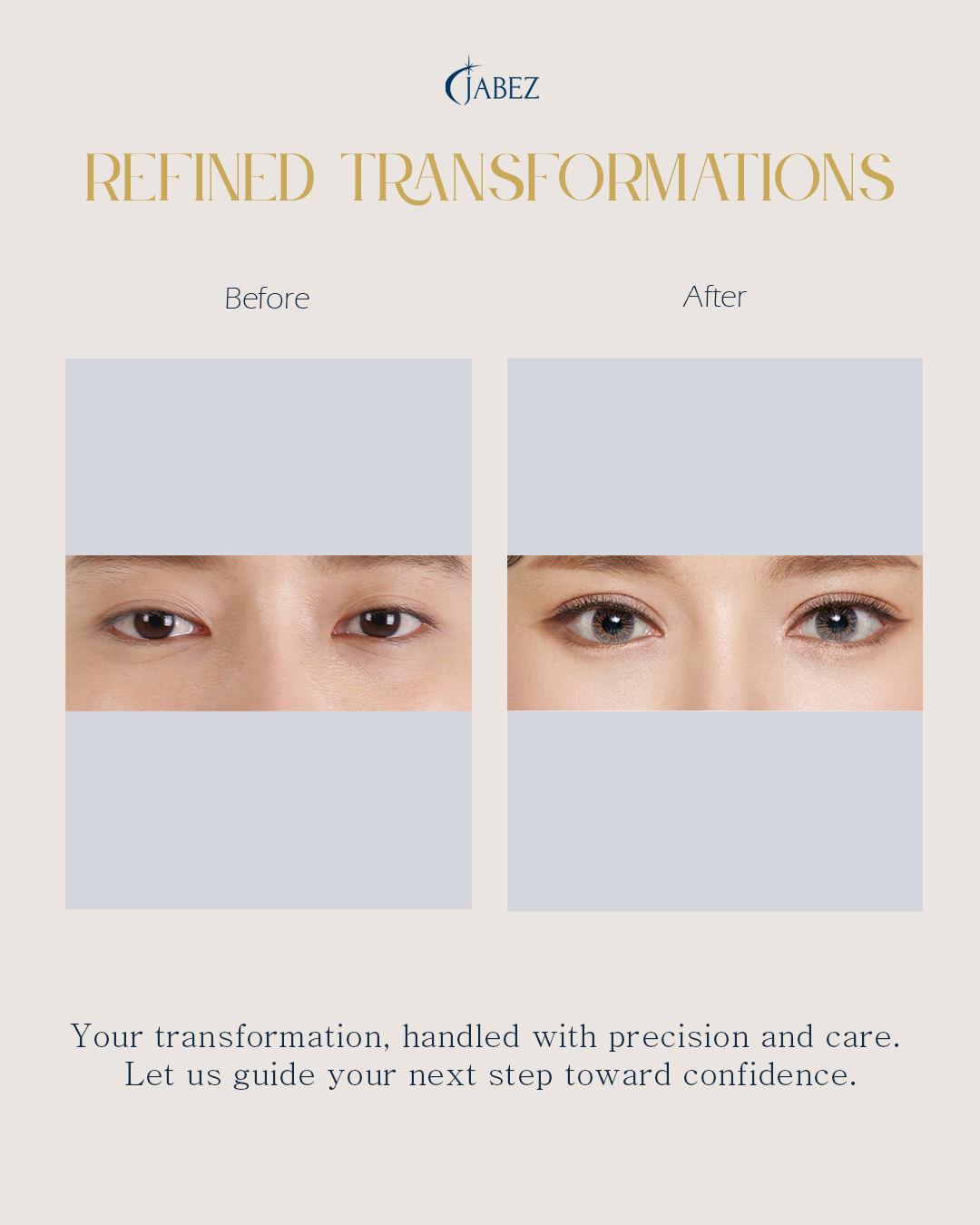 Meet Our Patients 22 eye treatment korea