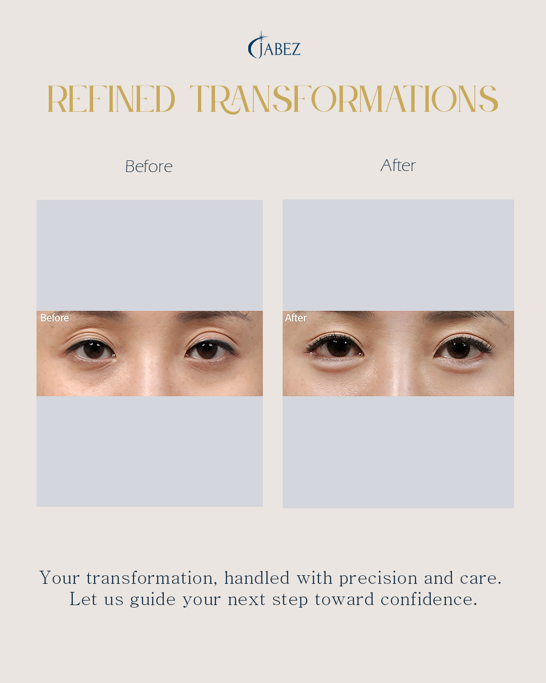 Meet Our Patients 23 eye treatment korea