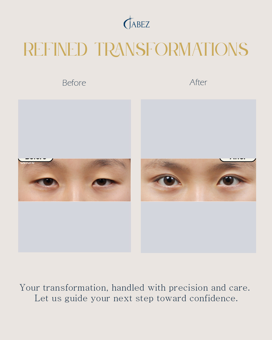 Meet Our Patients 24 eye treatment korea