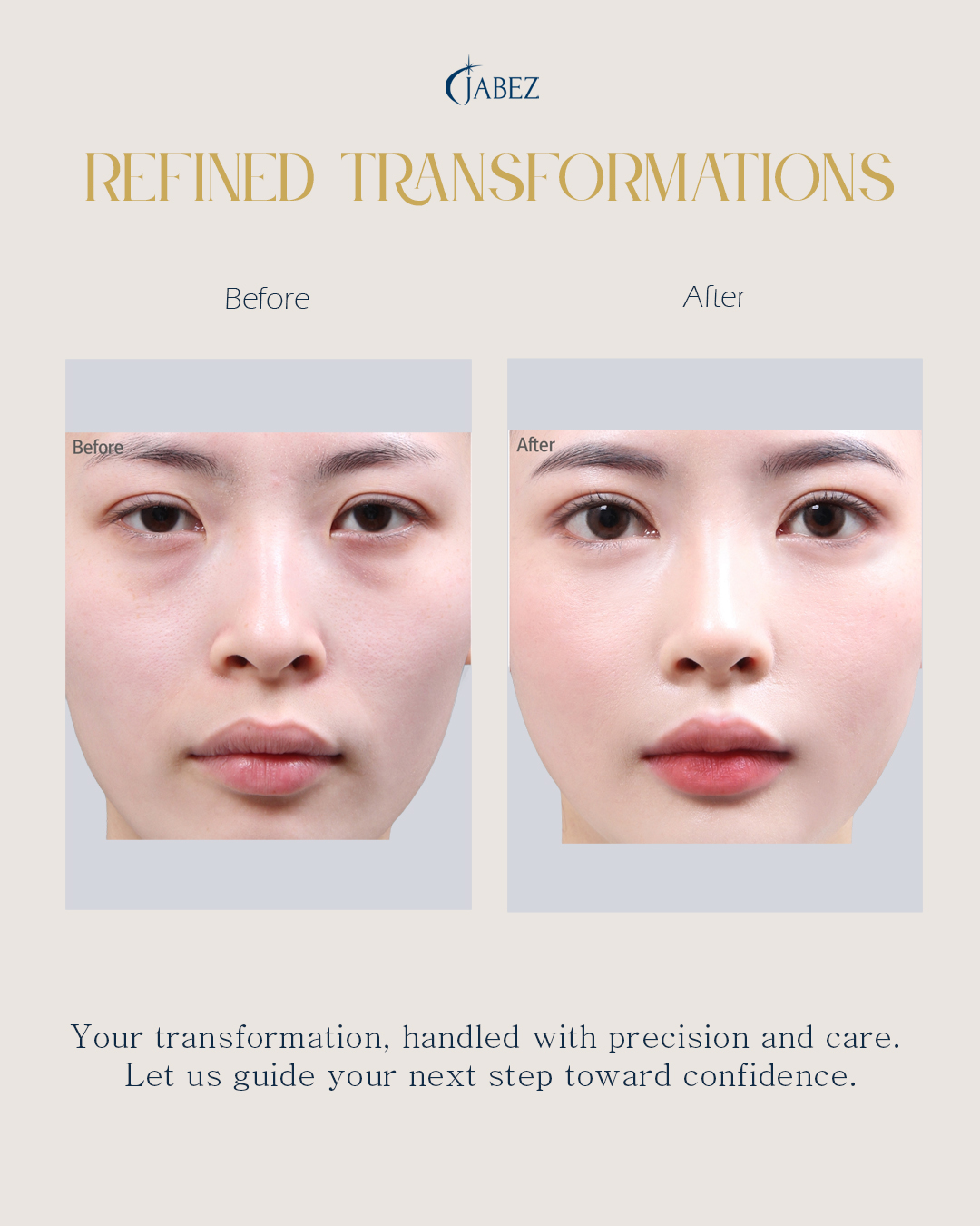 Meet Our Patients 25 eye treatment korea