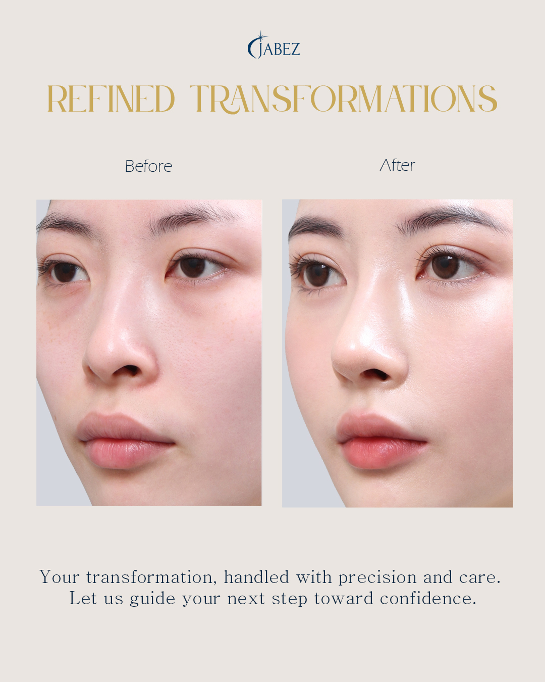 Meet Our Patients 27 eye treatment korea