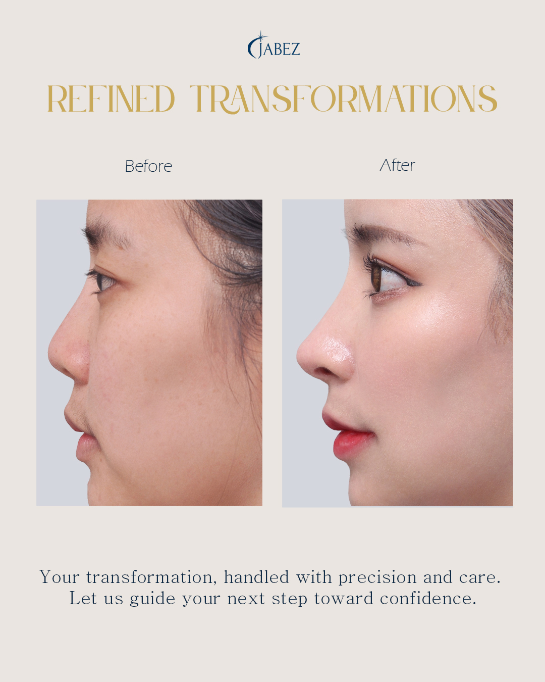 Meet Our Patients 28 eye treatment korea