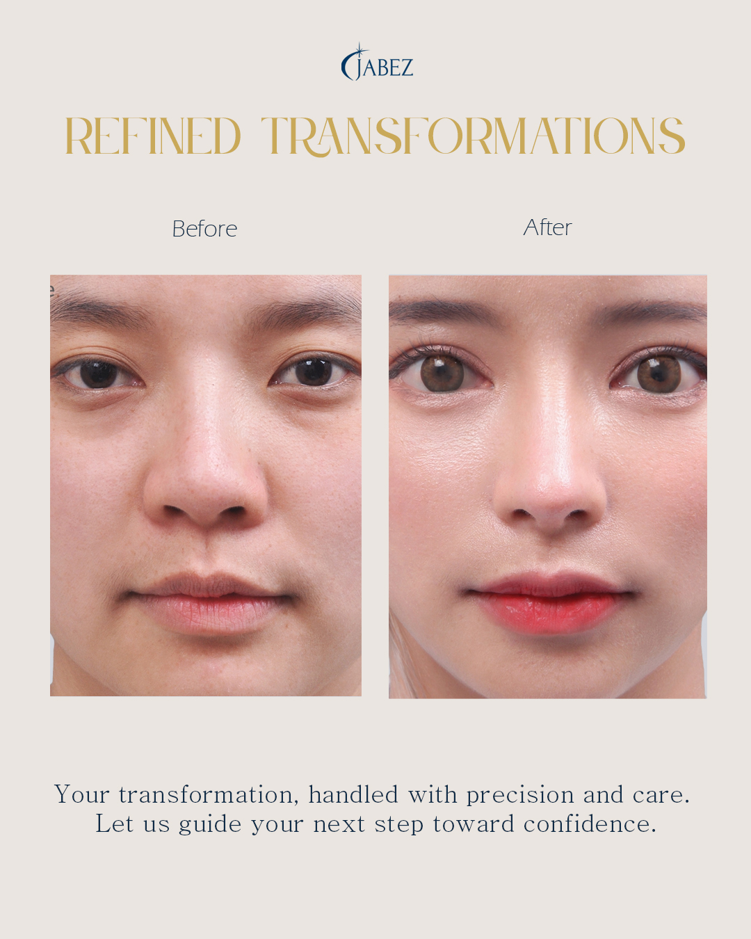 Meet Our Patients 29 eye treatment korea