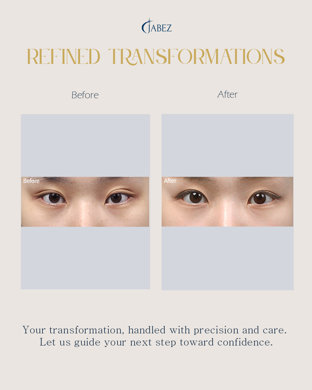 Meet Our Patients 3 eye treatment korea