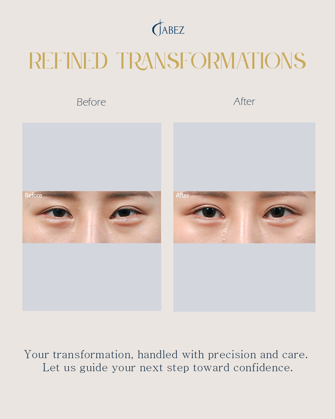 Meet Our Patients 79 eye treatment korea(1)