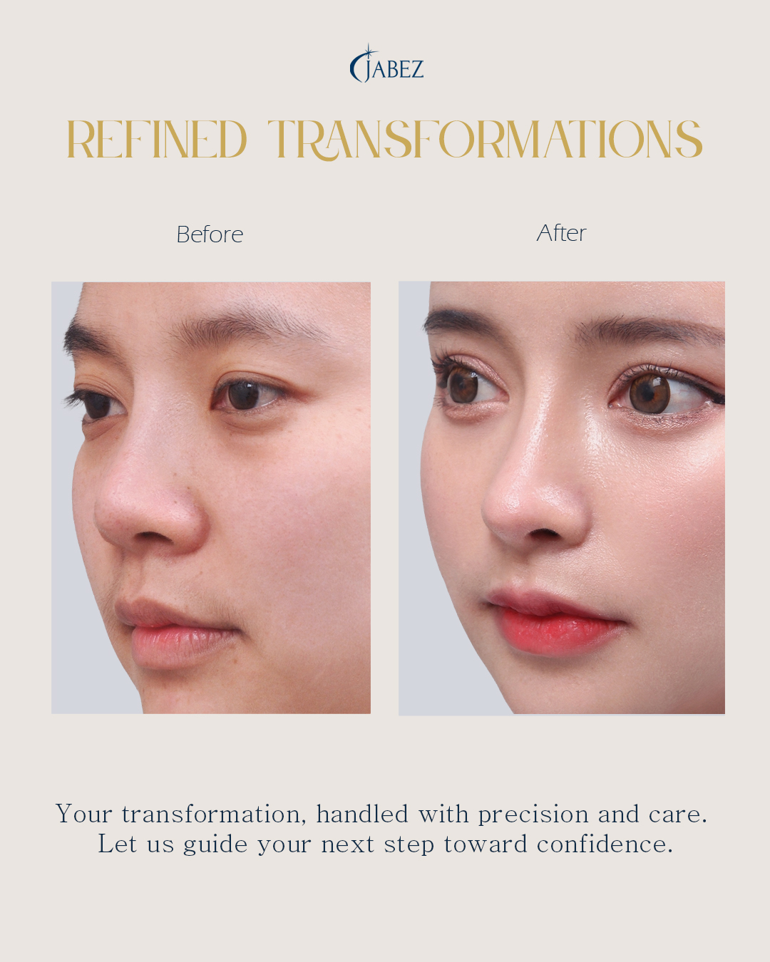 Meet Our Patients 30 eye treatment korea