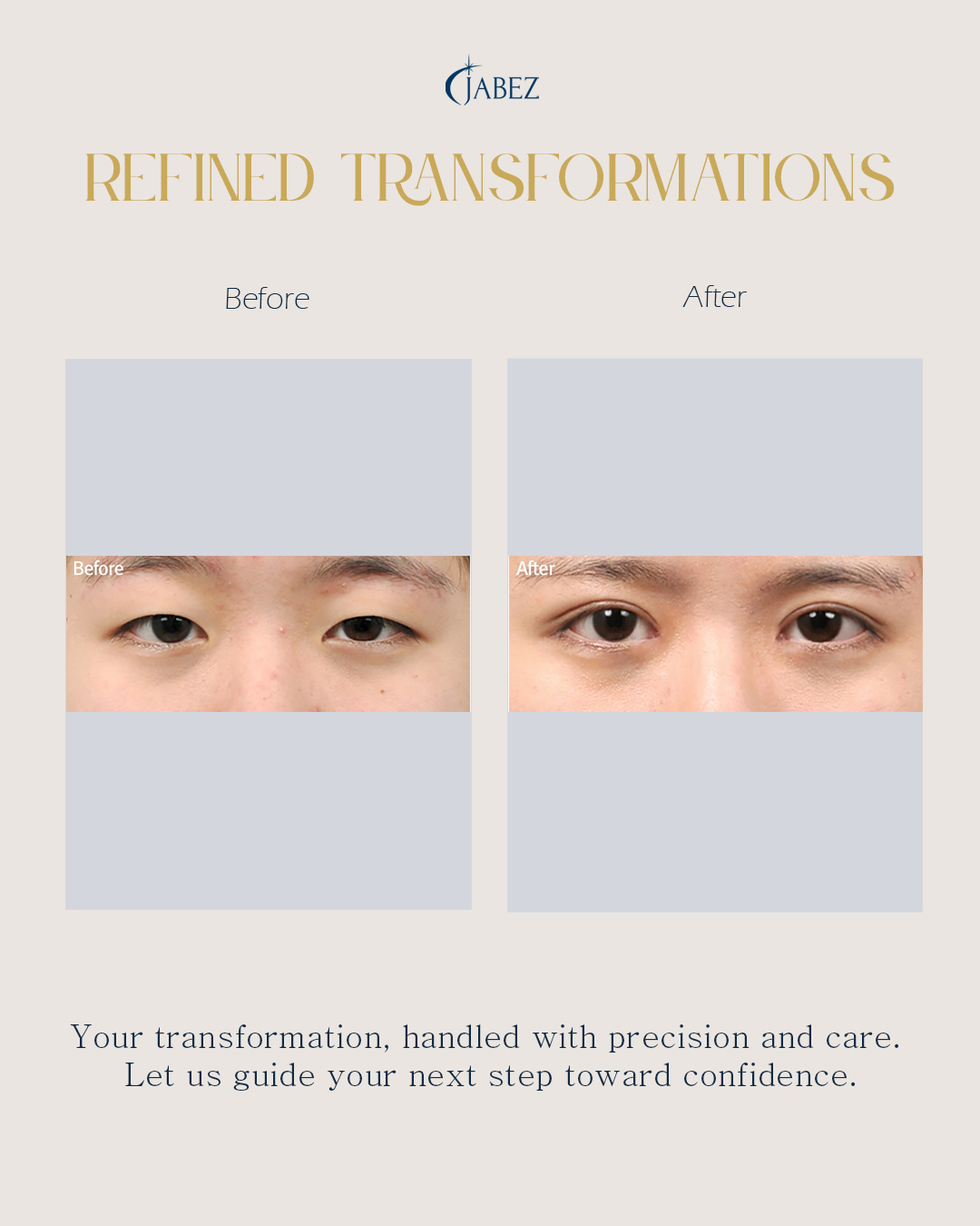 Meet Our Patients 4 eye treatment korea