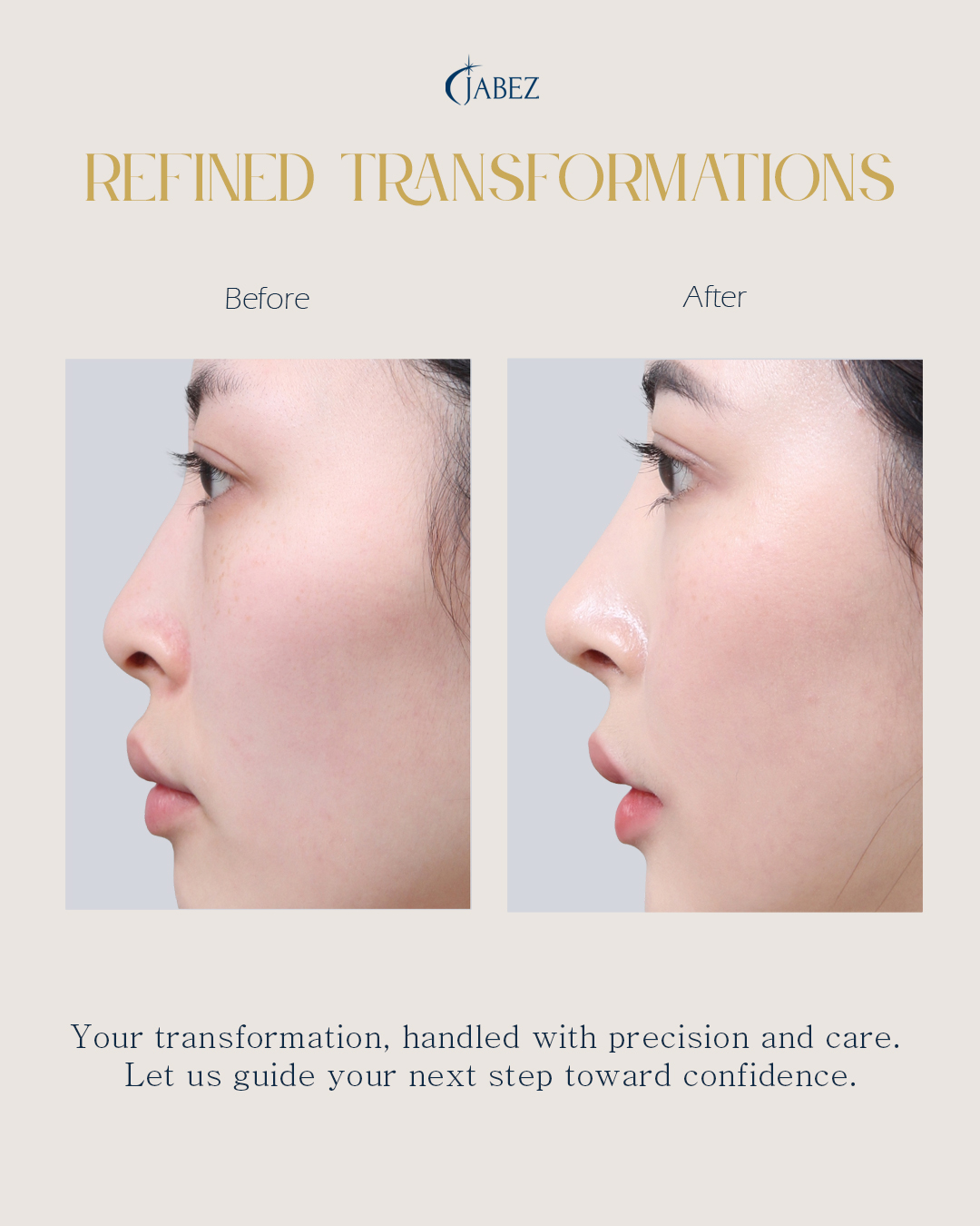 Meet Our Patients 80 eye treatment korea(1)