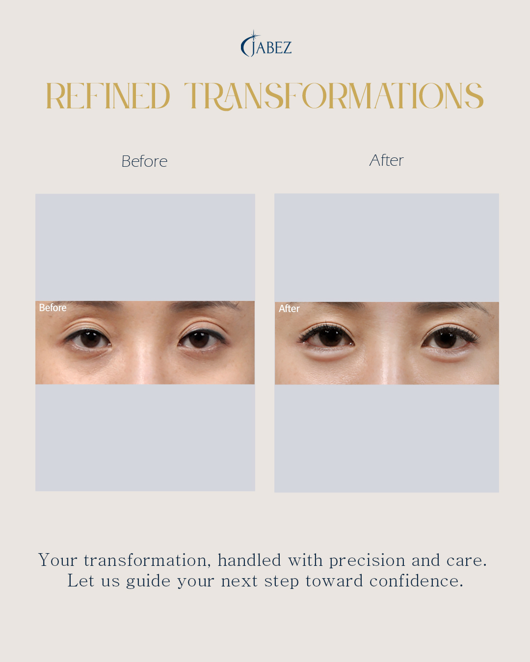 Meet Our Patients 6 eye treatment korea