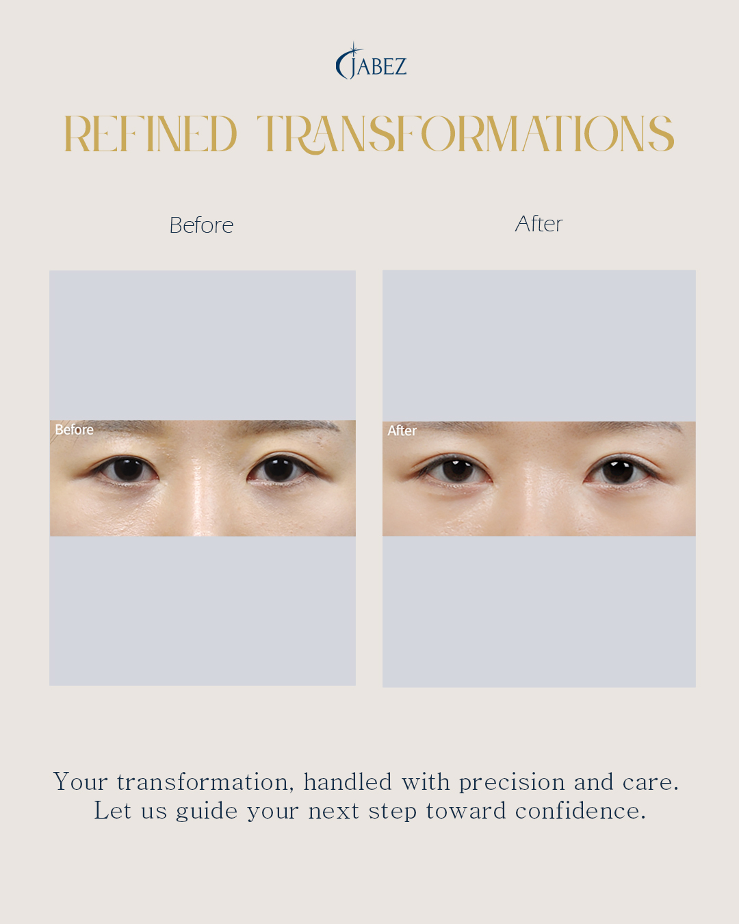 Meet Our Patients 7 eye treatment korea