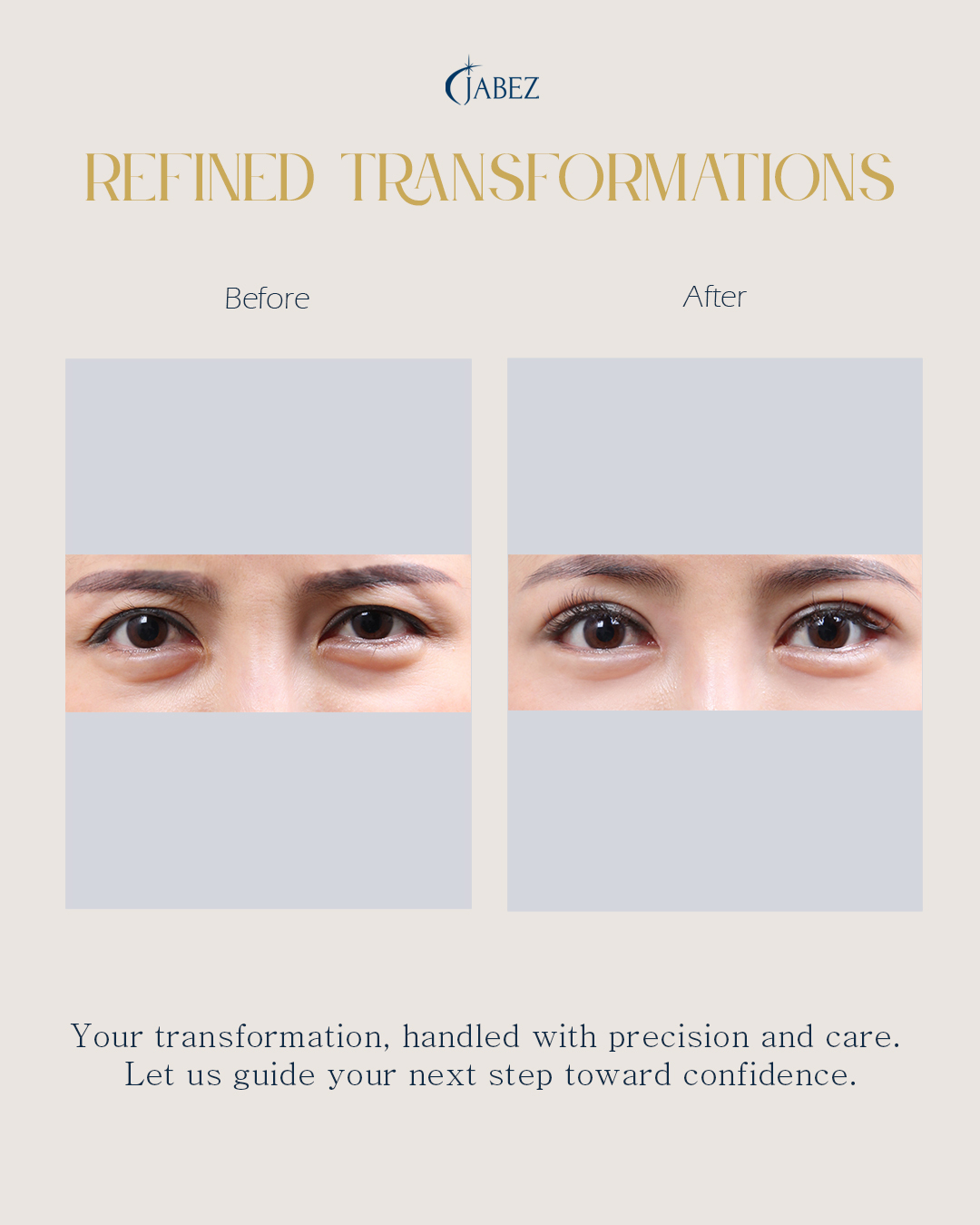 Meet Our Patients 84 eye treatment korea