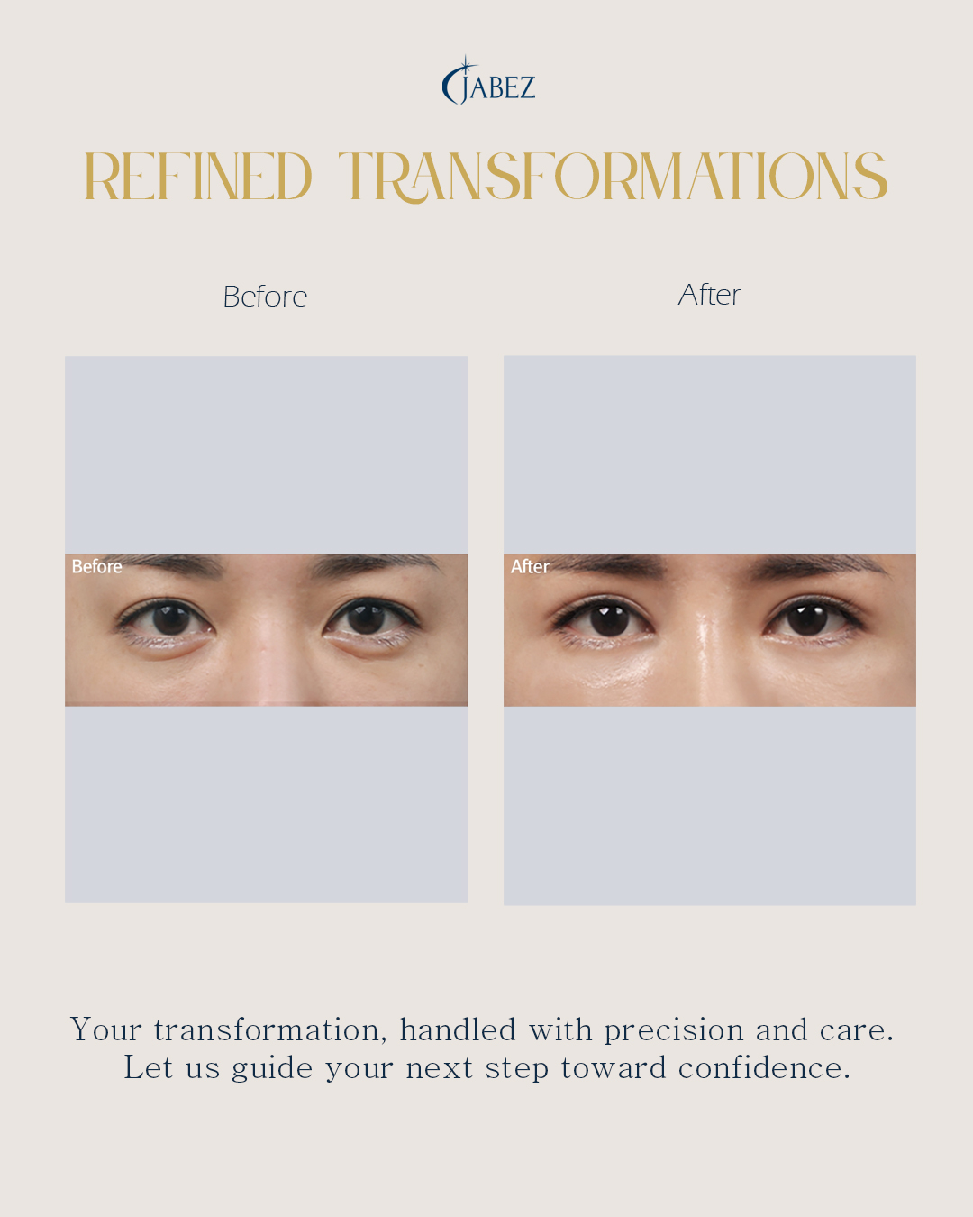 Meet Our Patients 9 eye treatment korea