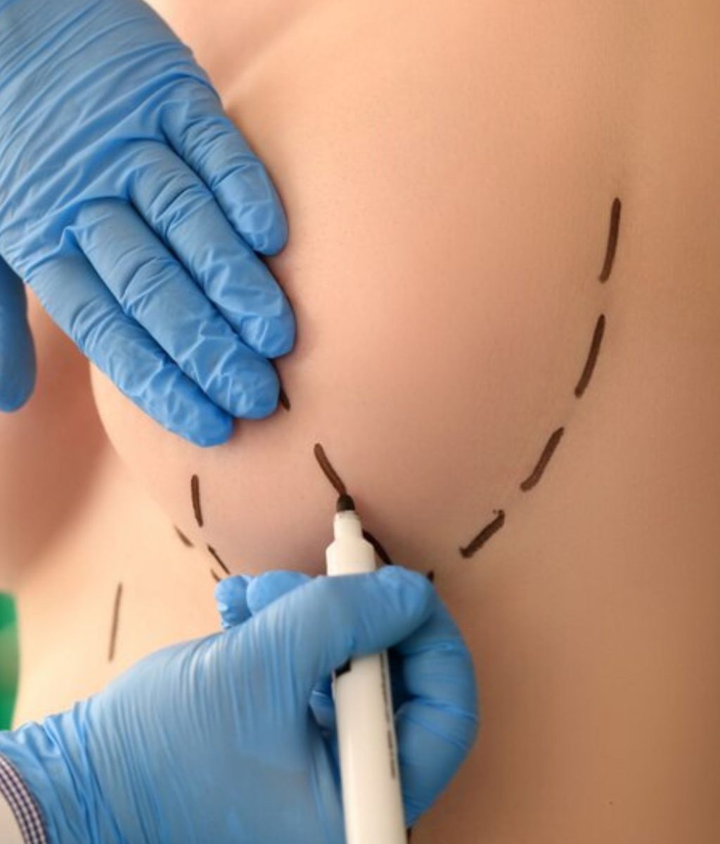 Breast Surgery