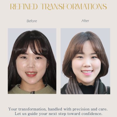 Home 16 Face lift treatment korea