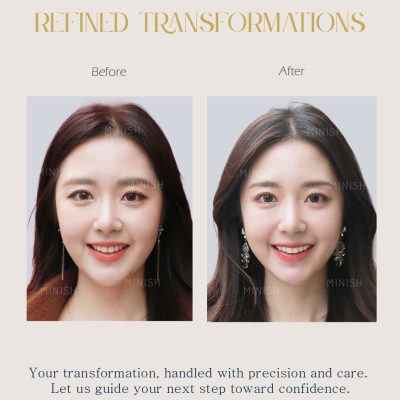 Home 19 Face rejuvenation treatment korea