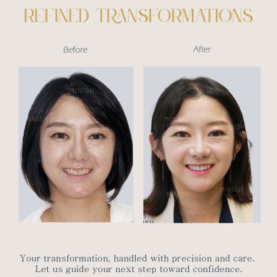 Home 25 Teeth Whitening Korea