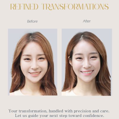 Home 24 Teeth Whitening Korea